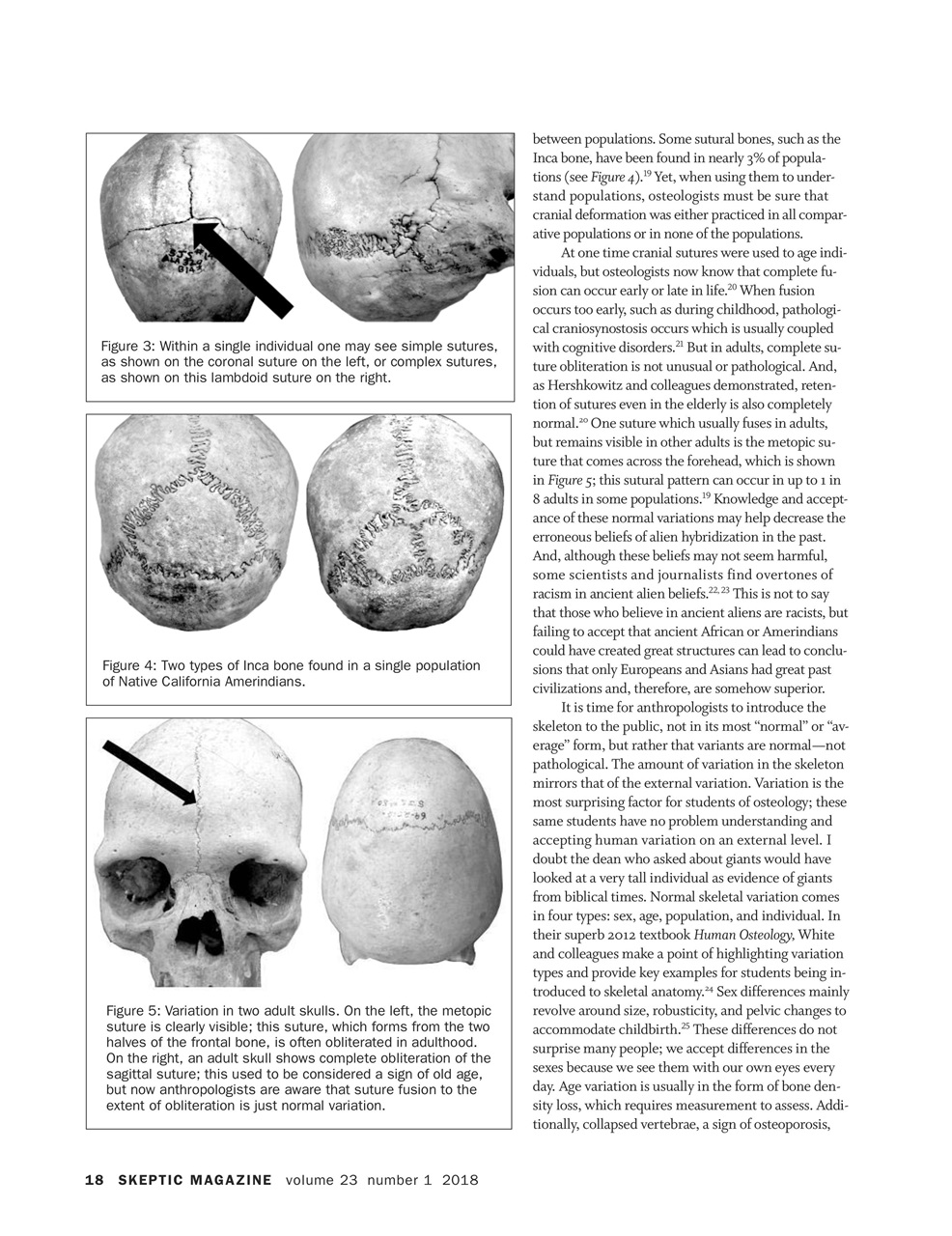Skeptic Preview Pages