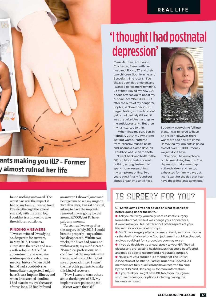 Closer Preview Pages