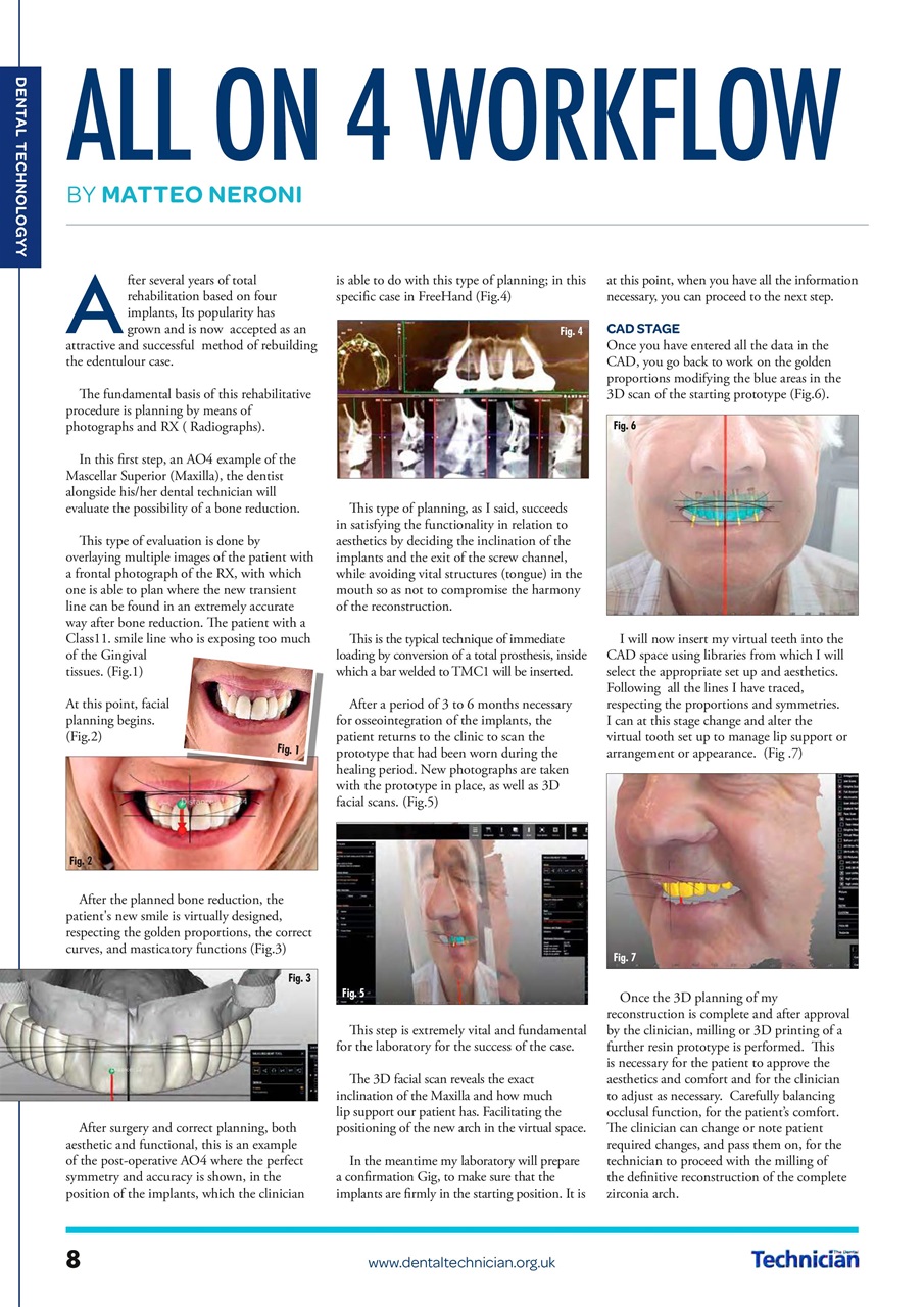 The Dental Technician Magazine Preview Pages