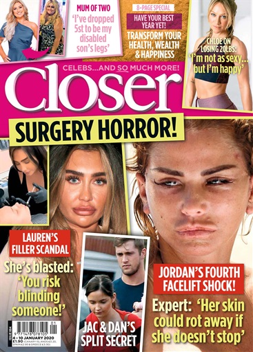 Closer issue 