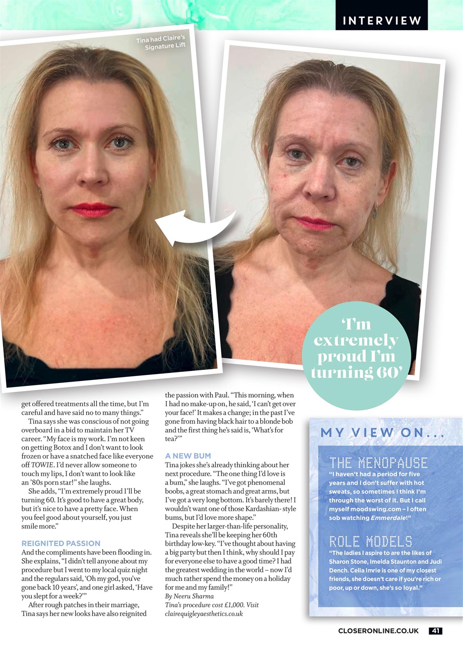 Closer Preview Pages