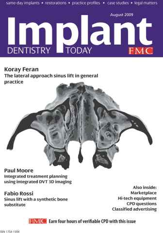 IDT – Implant Dentistry Today issue August 2009 Vol 3 Issue 3