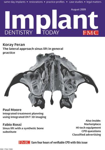 IDT – Implant Dentistry Today issue 