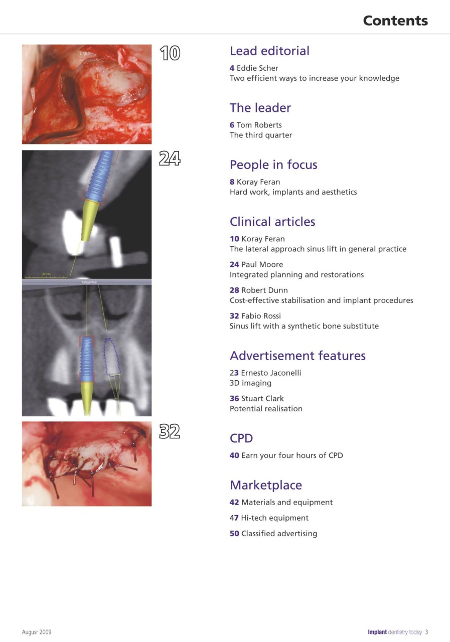 IDT – Implant Dentistry Today Preview Pages