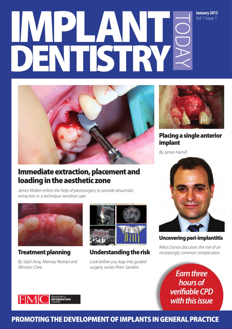 IDT – Implant Dentistry Today Preview Pages