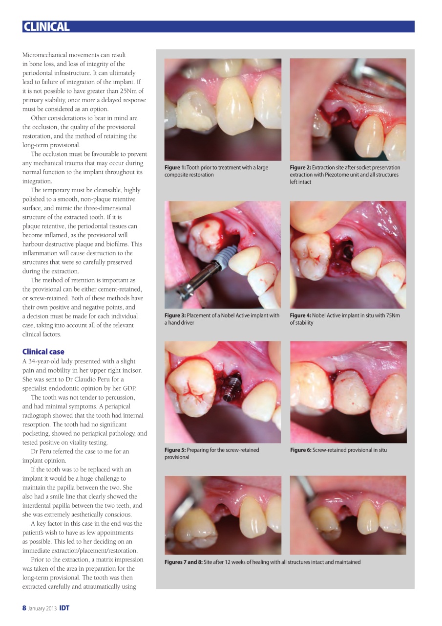 IDT – Implant Dentistry Today Preview Pages