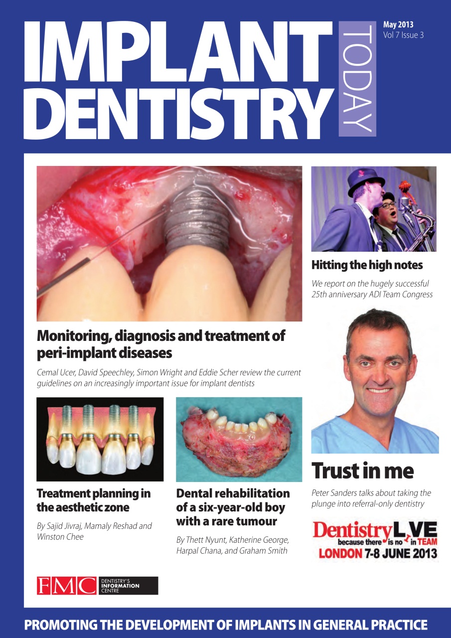 IDT – Implant Dentistry Today Preview Pages