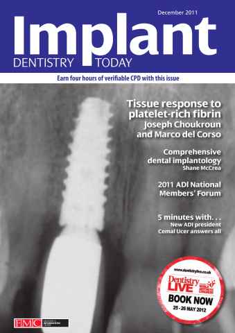 IDT – Implant Dentistry Today issue December 2011 Vol 5 Issue 4
