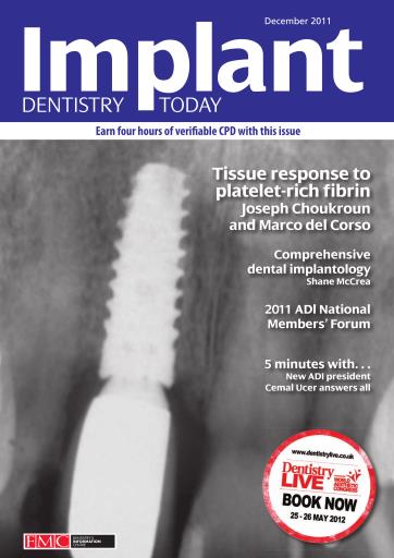 IDT – Implant Dentistry Today issue 