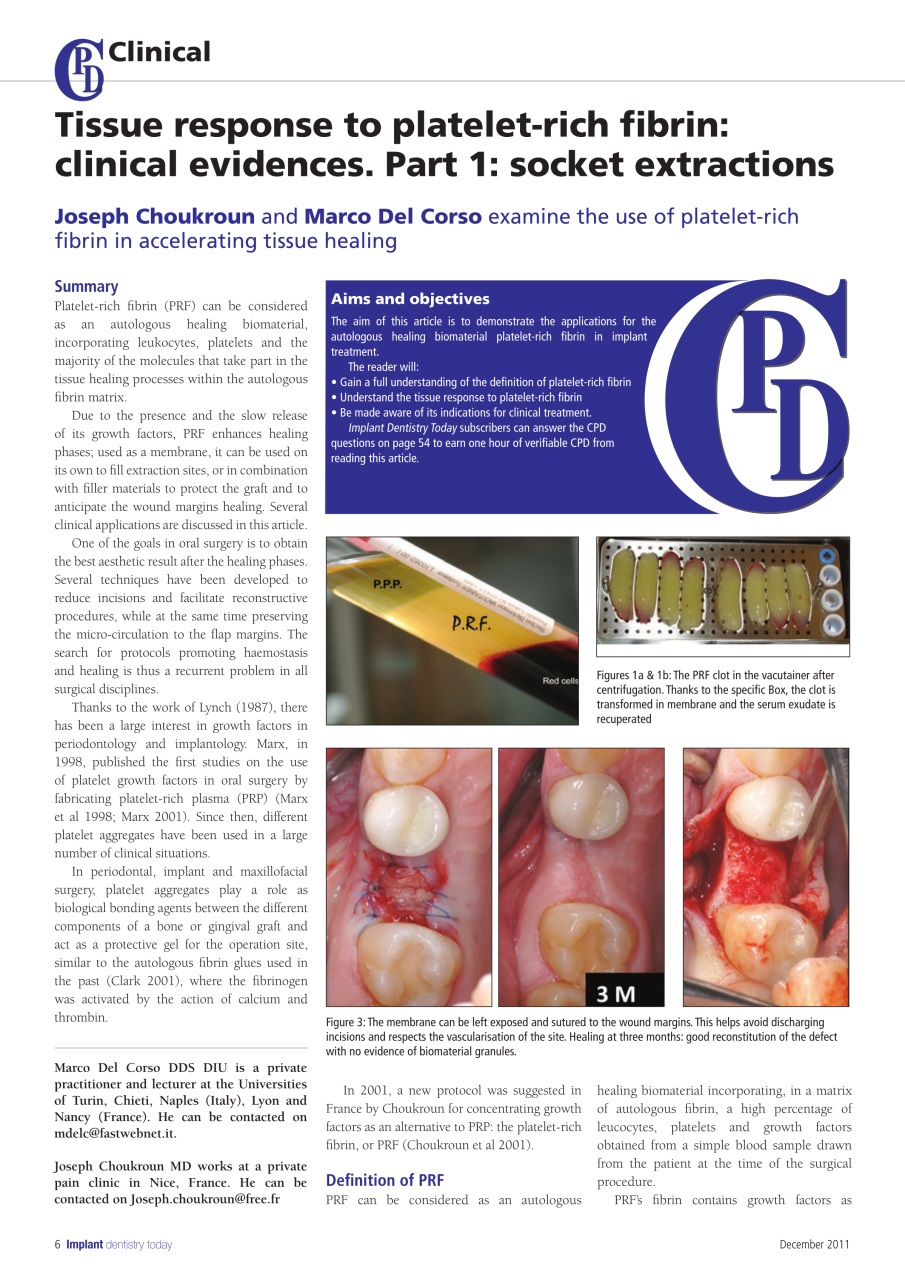 IDT – Implant Dentistry Today Preview Pages