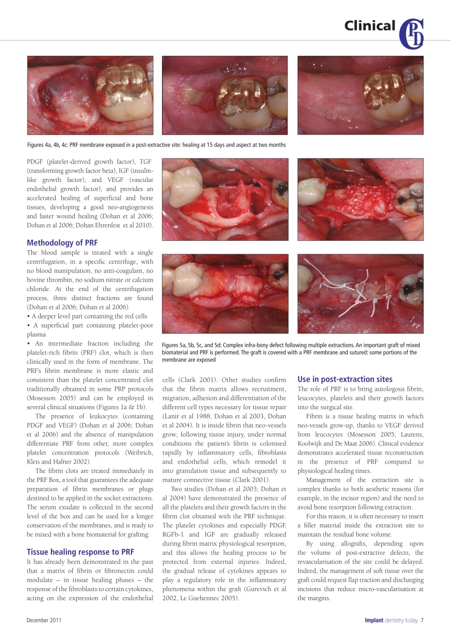 IDT – Implant Dentistry Today Preview Pages