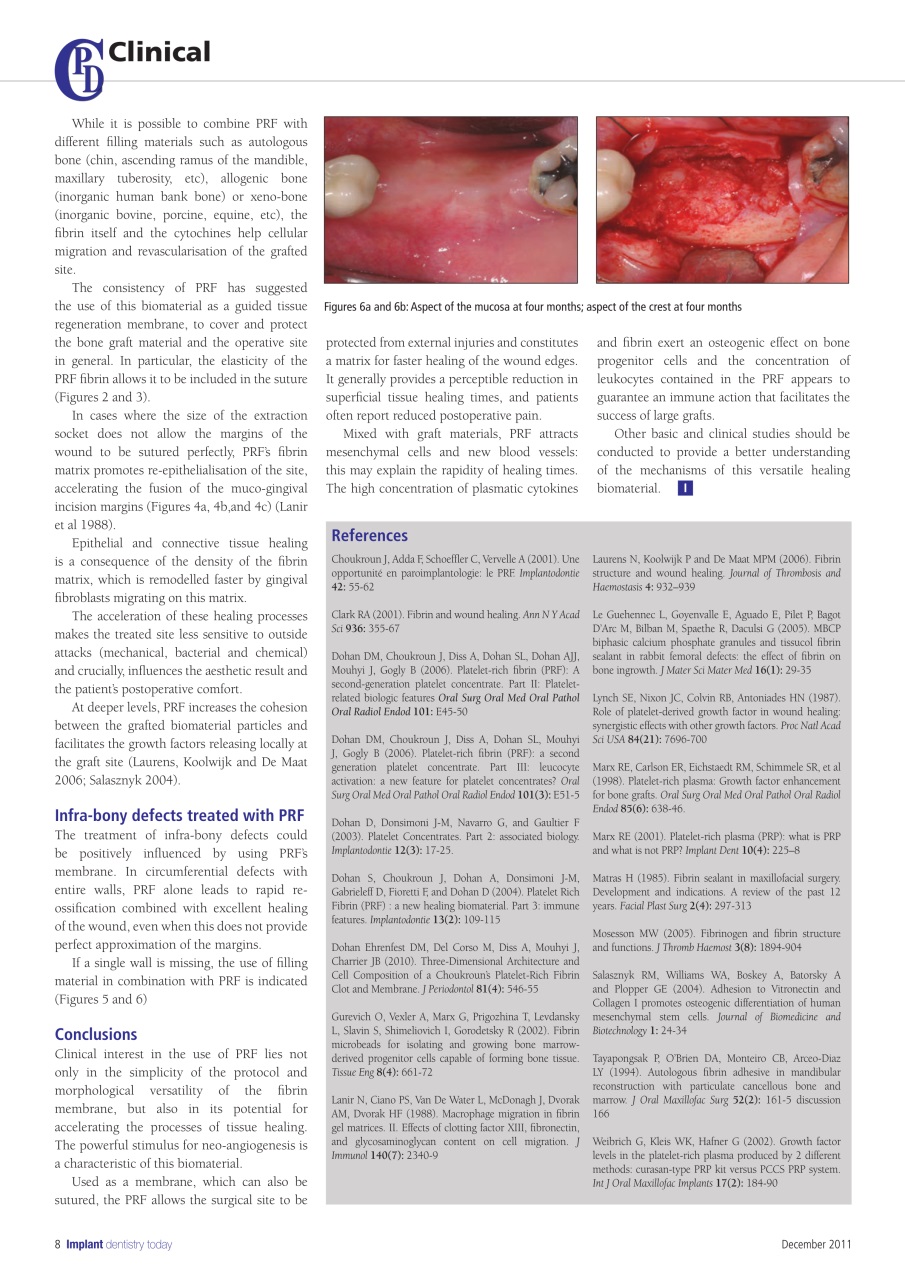 IDT – Implant Dentistry Today Preview Pages