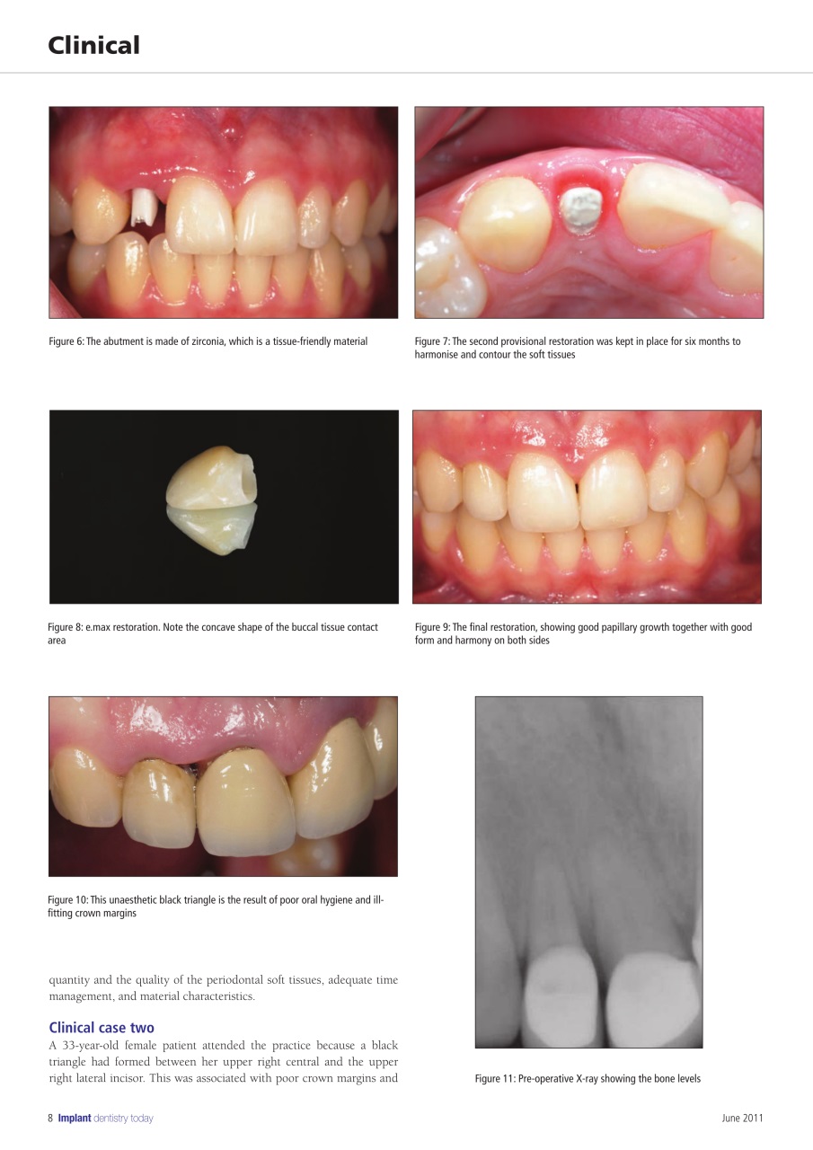 IDT – Implant Dentistry Today Preview Pages