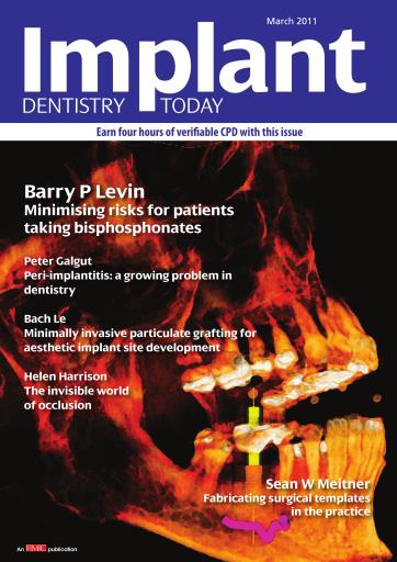 IDT – Implant Dentistry Today issue 