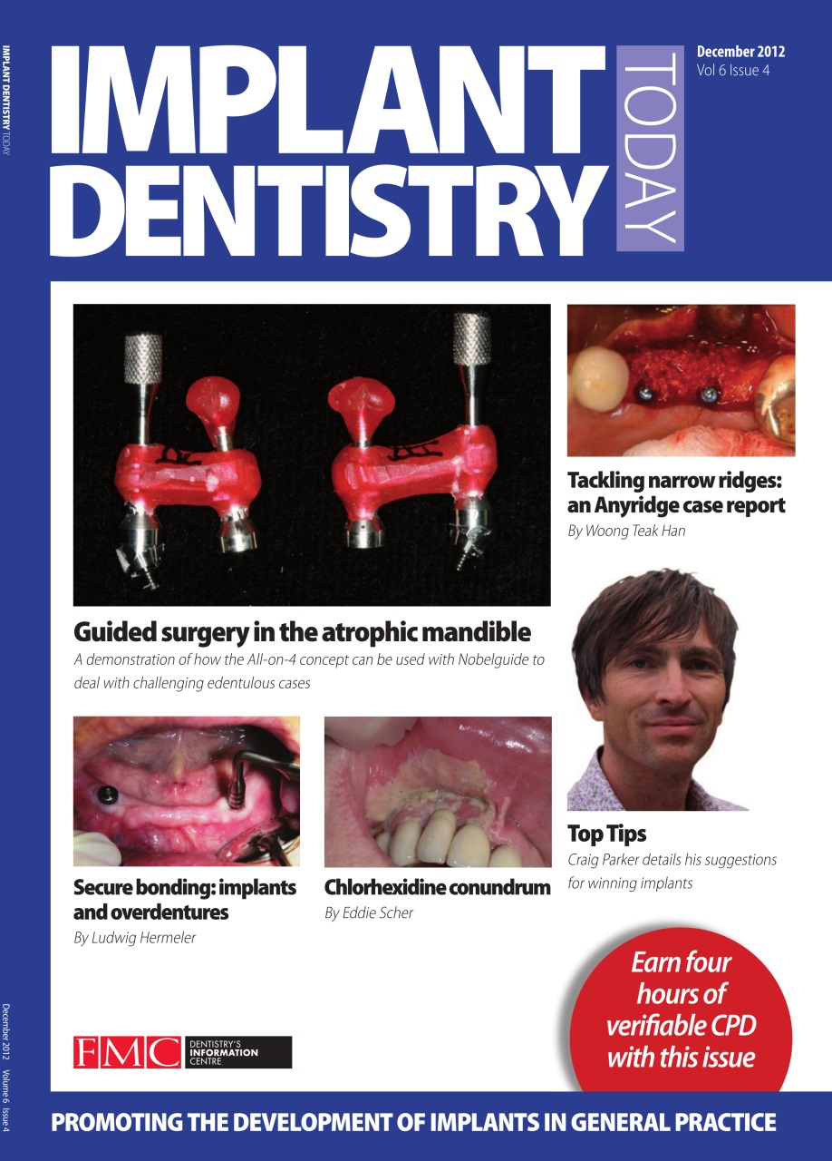 IDT – Implant Dentistry Today Preview Pages