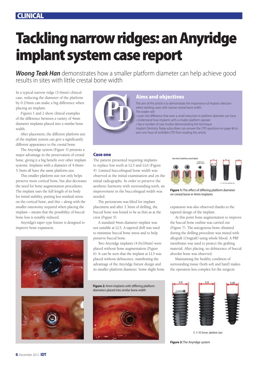 IDT – Implant Dentistry Today Preview Pages