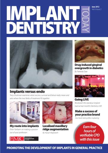 IDT – Implant Dentistry Today issue 