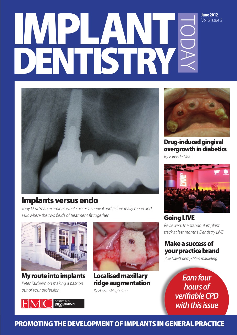 IDT – Implant Dentistry Today Preview Pages