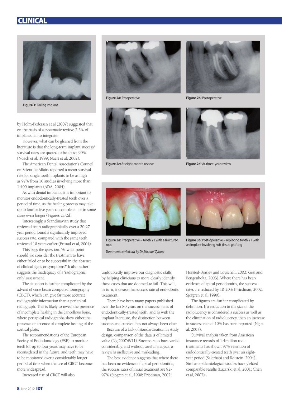 IDT – Implant Dentistry Today Preview Pages