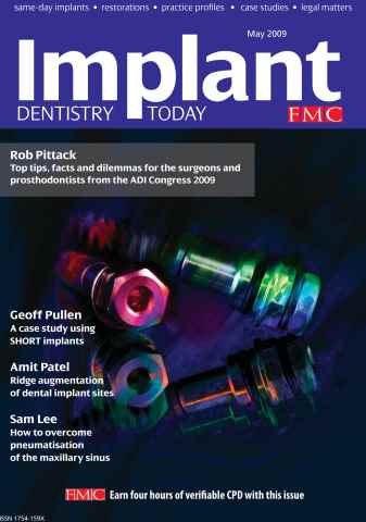 IDT – Implant Dentistry Today issue May 2009