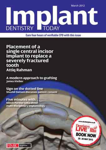 IDT – Implant Dentistry Today issue March 2012 Vo 6 Issue 1