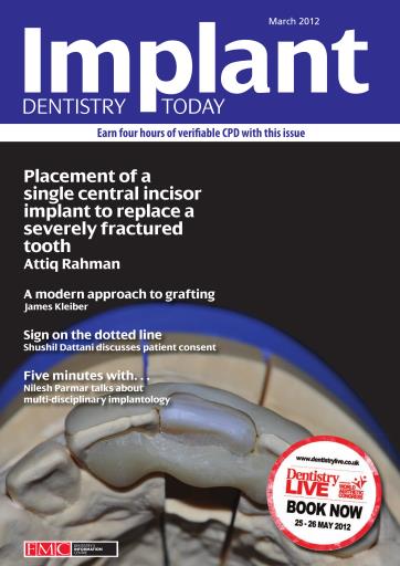 IDT – Implant Dentistry Today issue 
