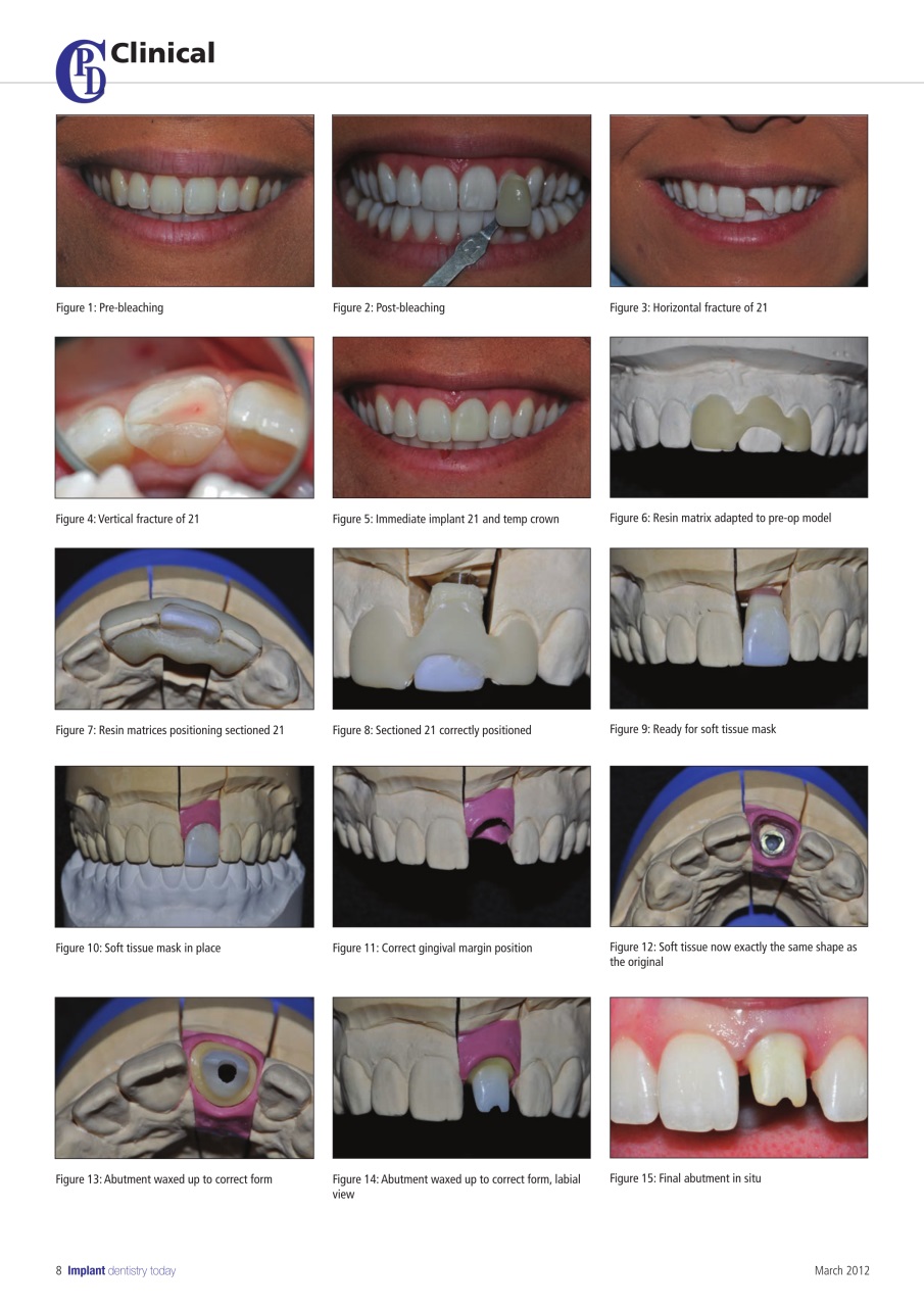 IDT – Implant Dentistry Today Preview Pages