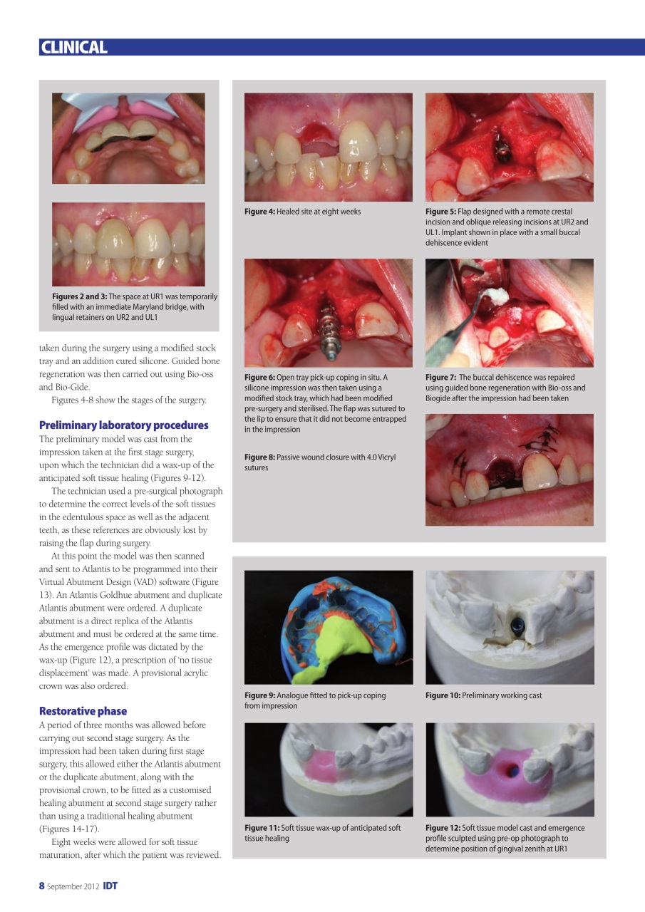 IDT – Implant Dentistry Today Preview Pages