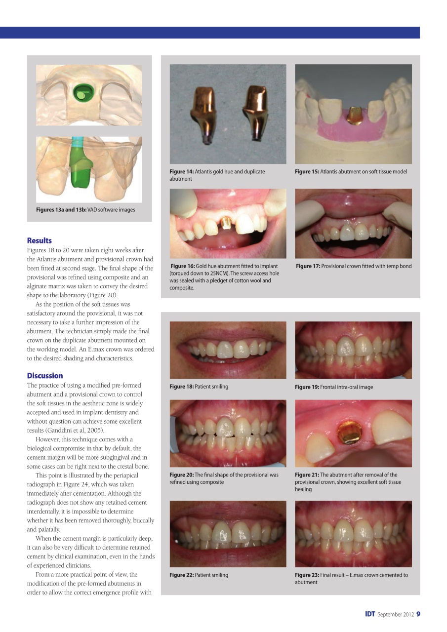 IDT – Implant Dentistry Today Preview Pages
