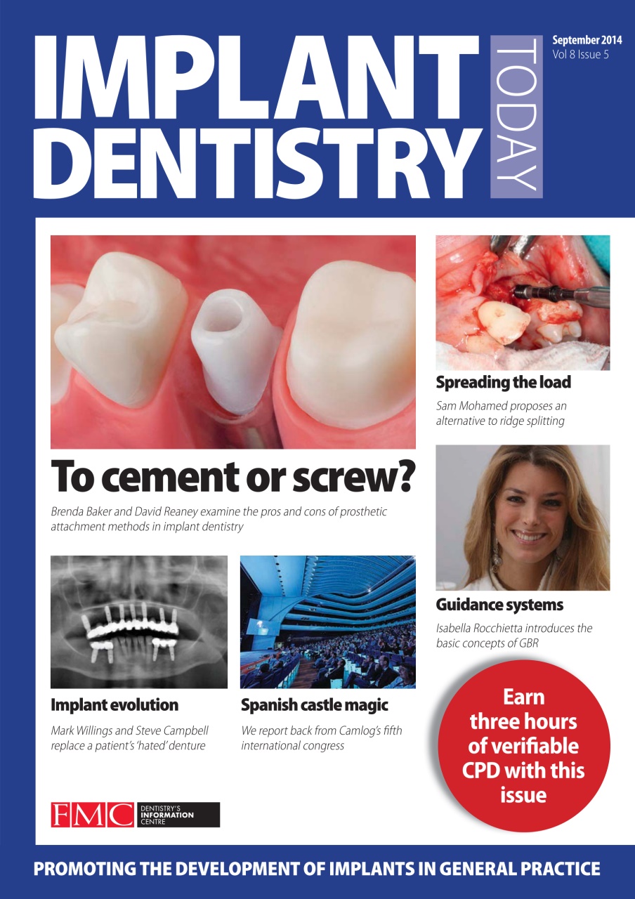 IDT – Implant Dentistry Today Preview Pages