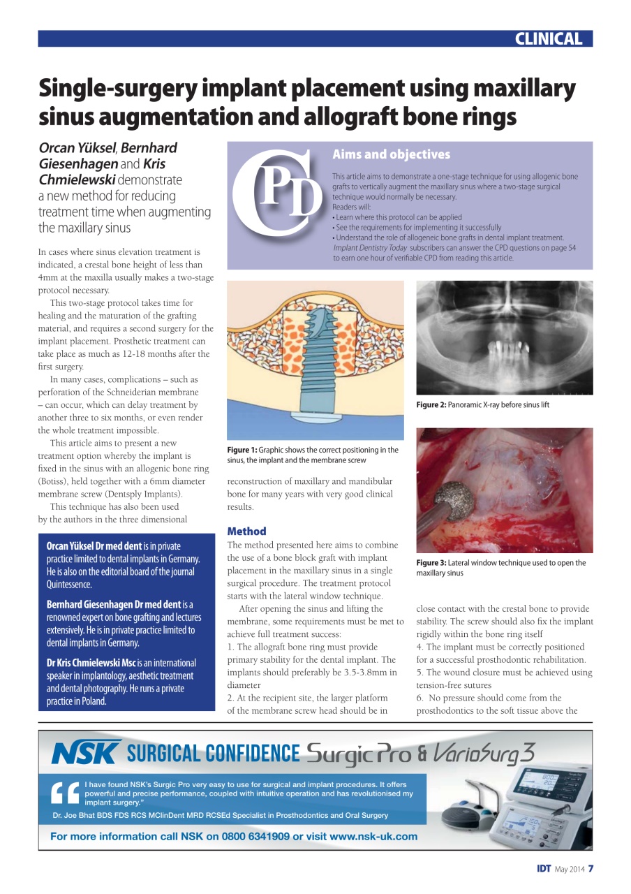 IDT – Implant Dentistry Today Preview Pages