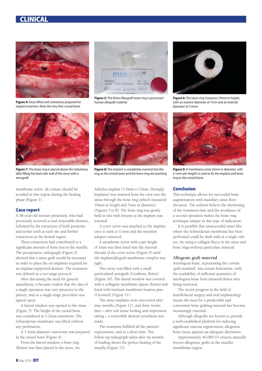 IDT – Implant Dentistry Today Preview Pages