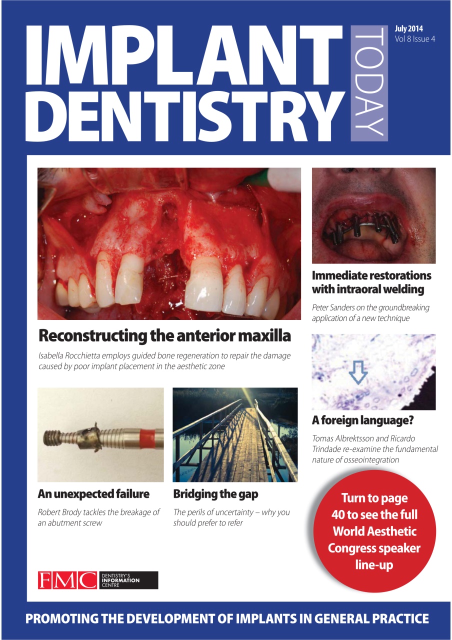 IDT – Implant Dentistry Today Preview Pages
