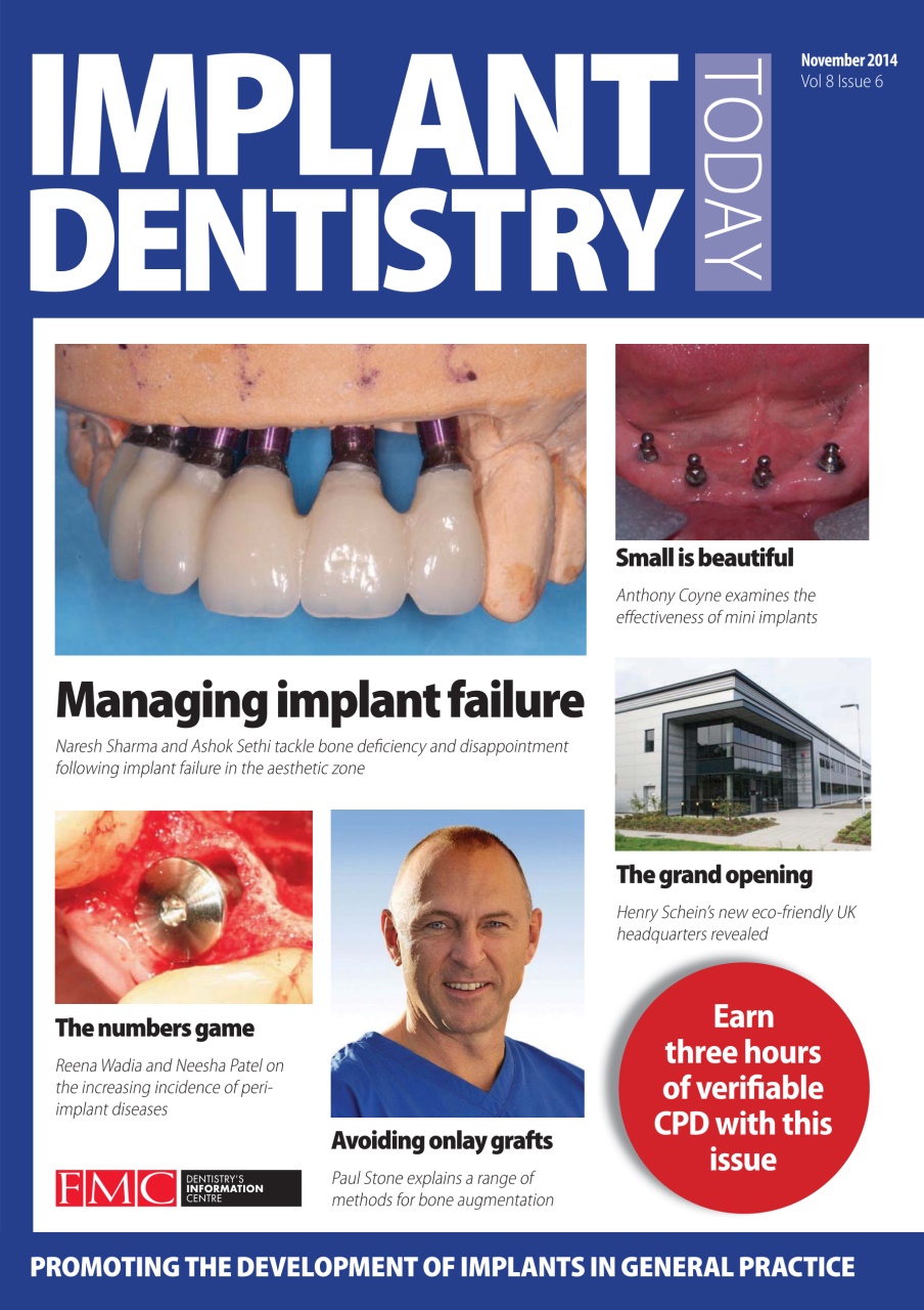 IDT – Implant Dentistry Today Preview Pages