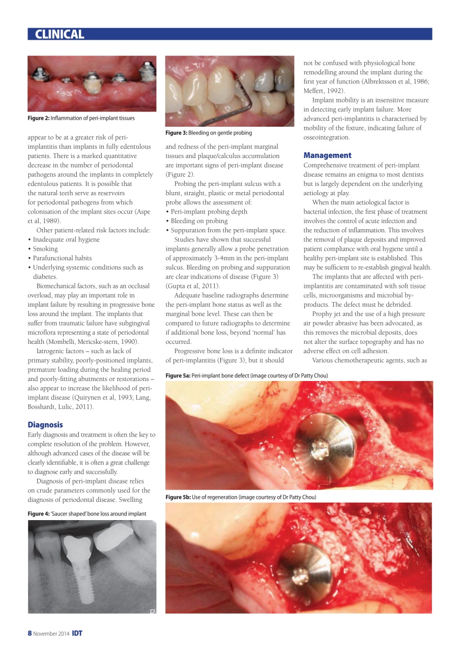 IDT – Implant Dentistry Today Preview Pages