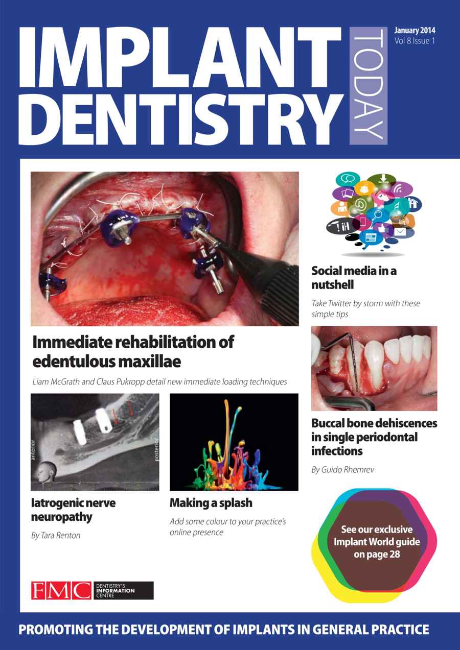 IDT – Implant Dentistry Today issue January 2014 Volume 8 Issue 1