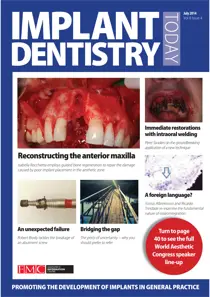 IDT – Implant Dentistry Today July 2014 Volume 8 Issue 4