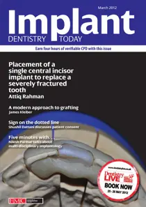 IDT – Implant Dentistry Today March 2012 Vo 6 Issue 1